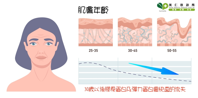 索夫波可以刺激膠原蛋白及彈力蛋白的增生