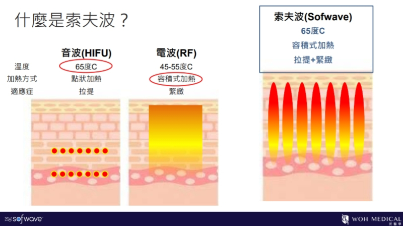 索夫波有音波的高溫及電波的容積式加熱方式，可以一次達到拉提+緊緻的功效