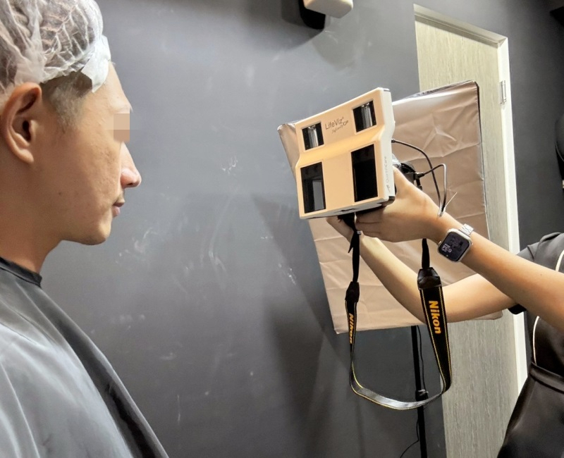 美仁欣在每次施作前、後都會為做全臉3D掃描