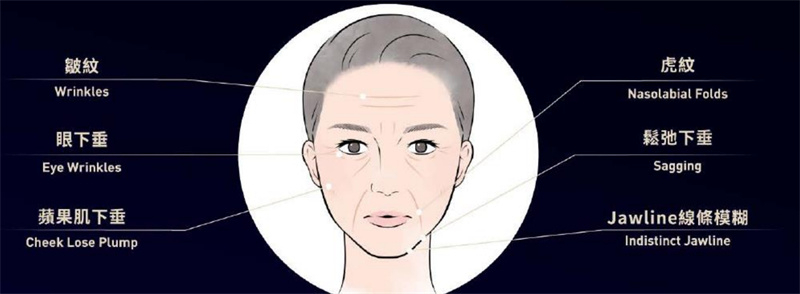 EMFACE菲斯波能夠解決6種肌膚老化問題