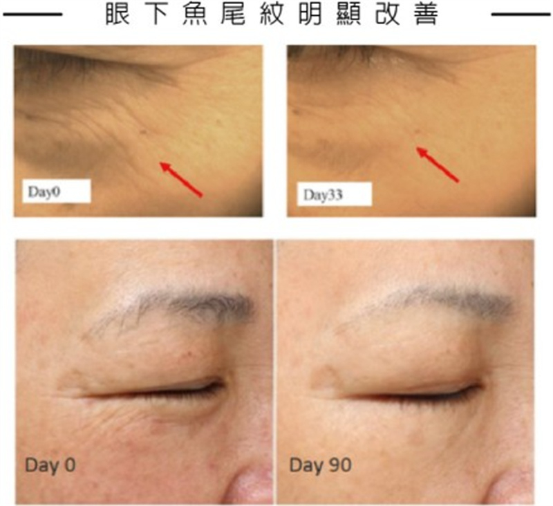 美仁欣外泌體效果展示