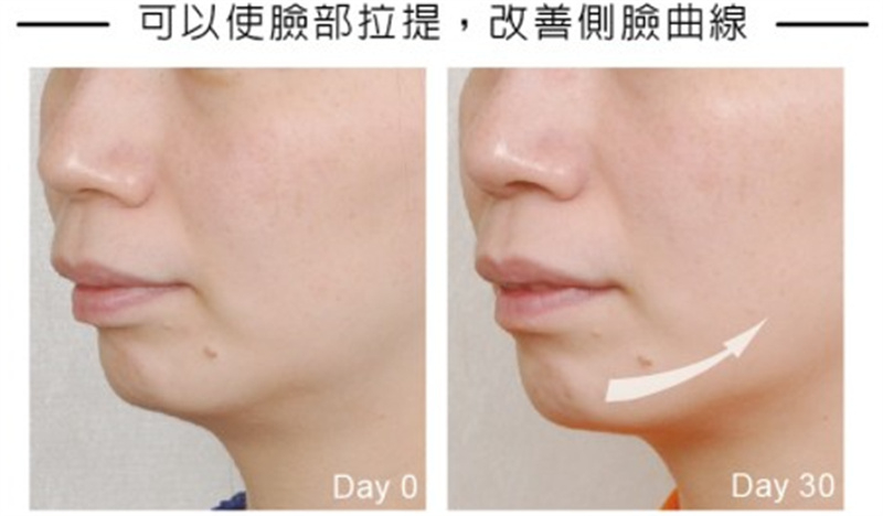 美仁欣外泌體效果展示