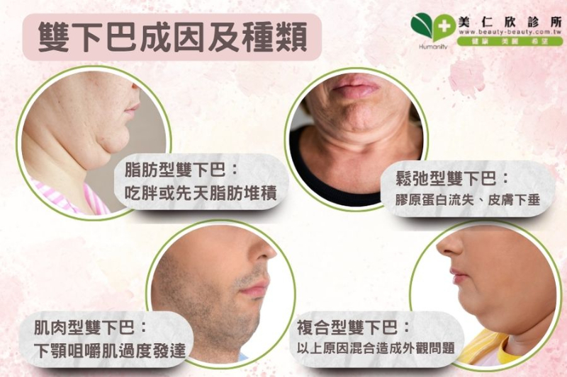 雙下巴成因
