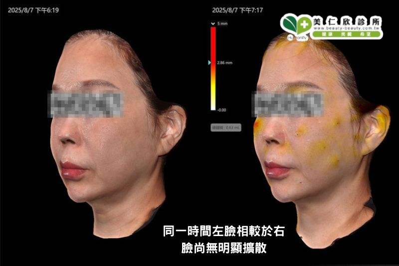 美仁欣逆時針效果