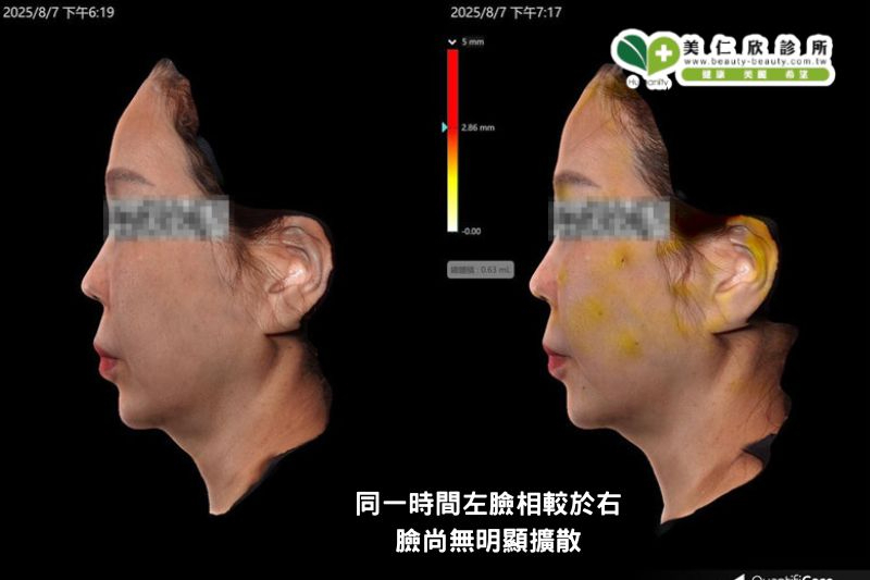美仁欣逆時針效果