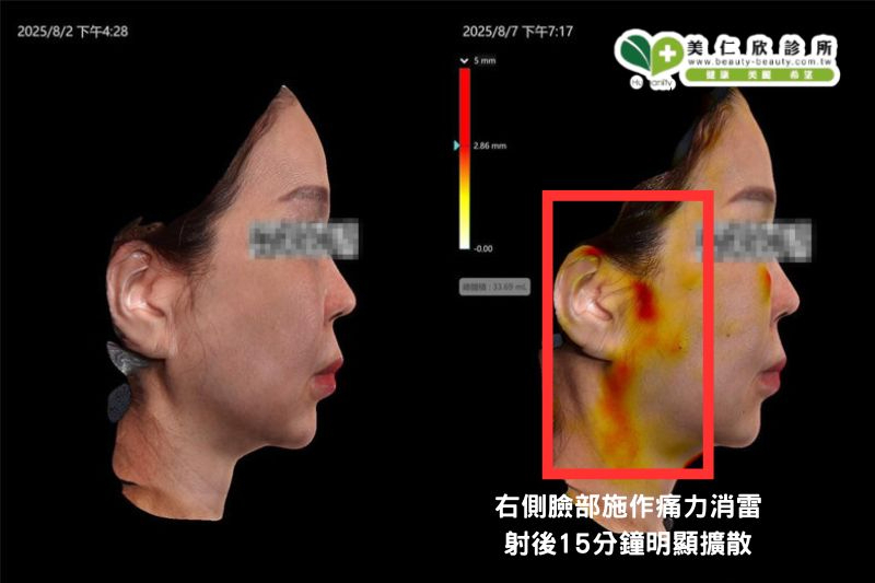 美仁欣逆時針效果