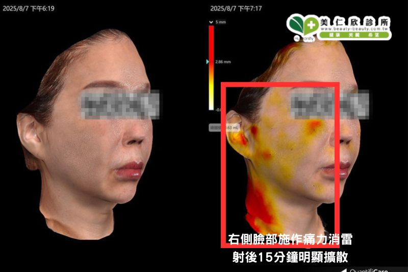 美仁欣逆時針效果