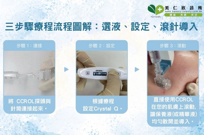  外泌體導入療程