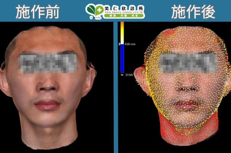 Crystal Q水晶摩比 搭配俏泌外泌體案例分享