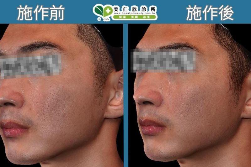Crystal Q水晶摩比 搭配俏泌外泌體案例分享