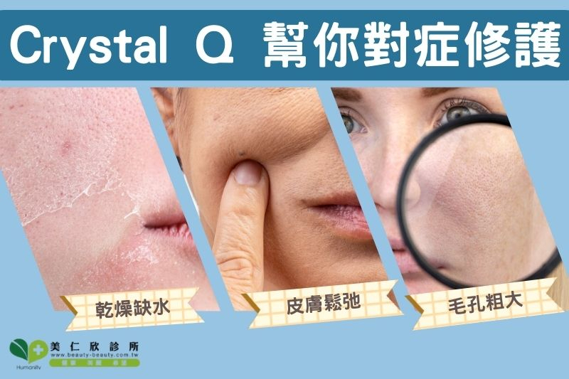 誰適合做水晶摩比療程？專業醫師這樣建議