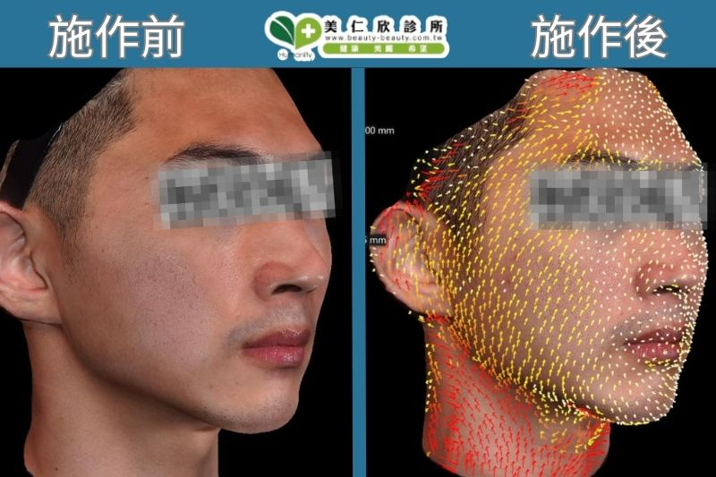 Crystal Q水晶摩比 搭配俏泌外泌體案例分享