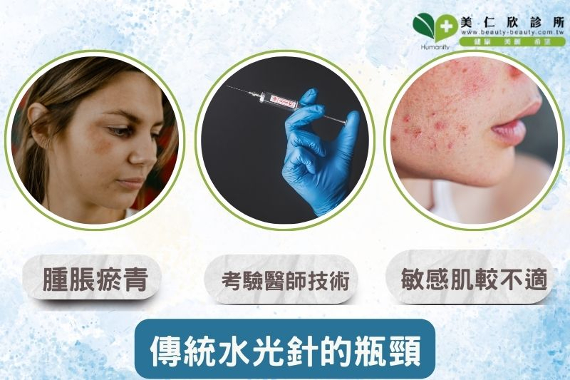 傳統水光針的瓶頸