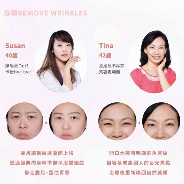 【永和醫美】如何挑選醫美診所？推薦6種醫美項目給剛入門的你