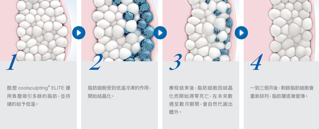 冷凍減脂原理