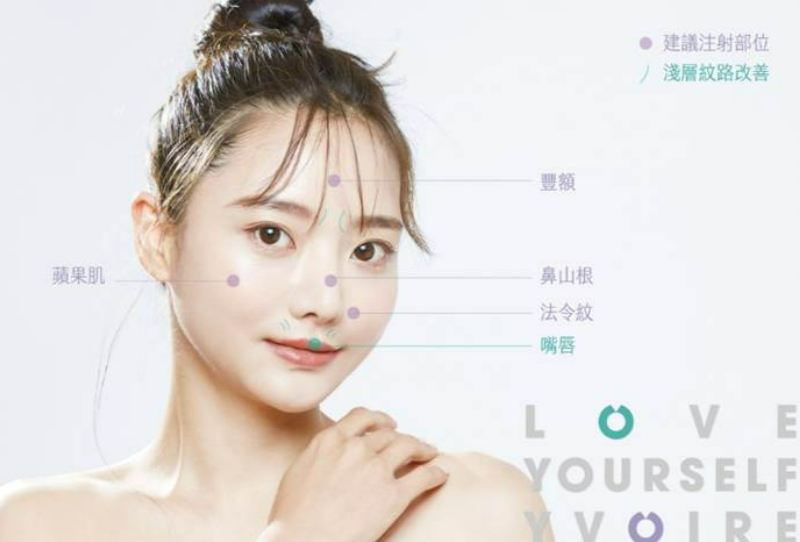 打玻尿酸效果