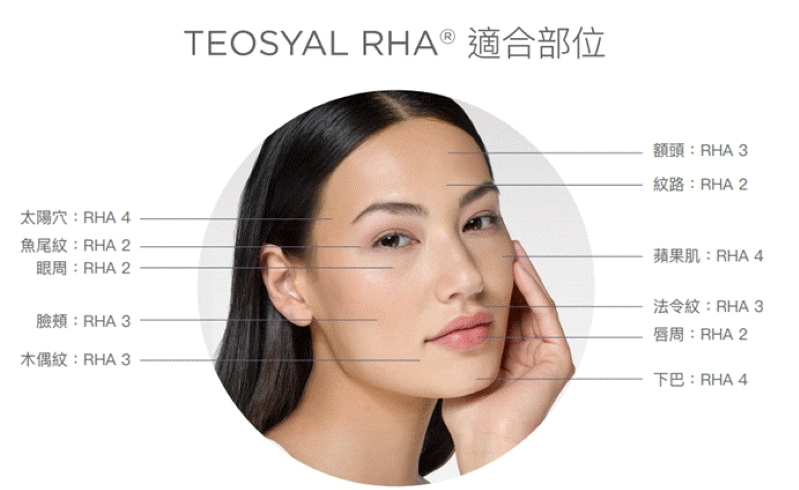TEOSYAL RHA玻尿酸