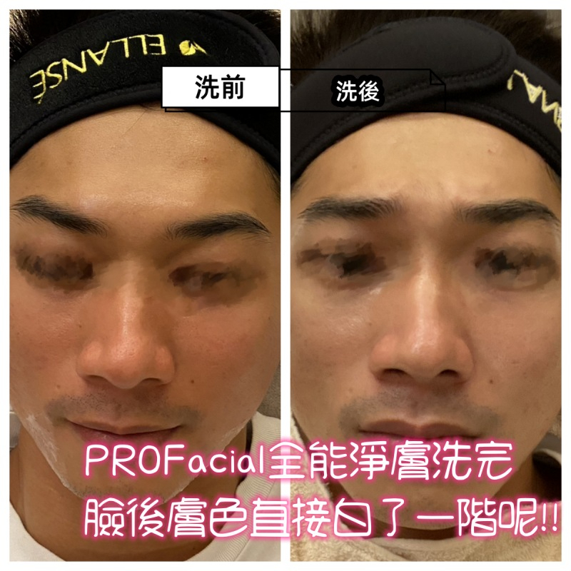 PROFacial超感秀全能淨膚儀