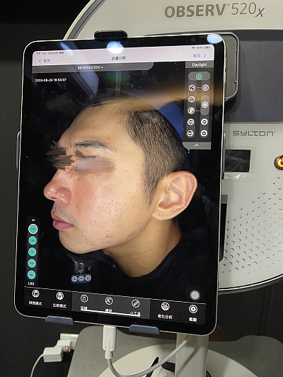 Observ全臉掃瞄儀