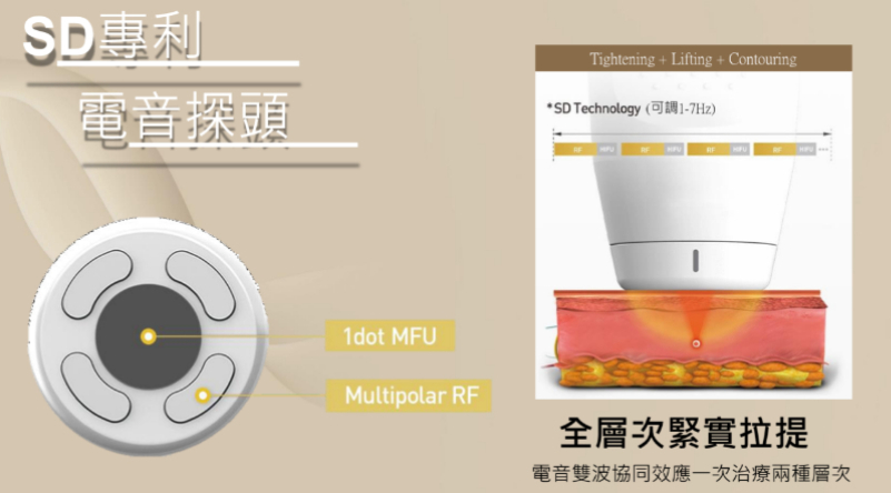 消除眼周細紋醫美療程推薦電音雙波